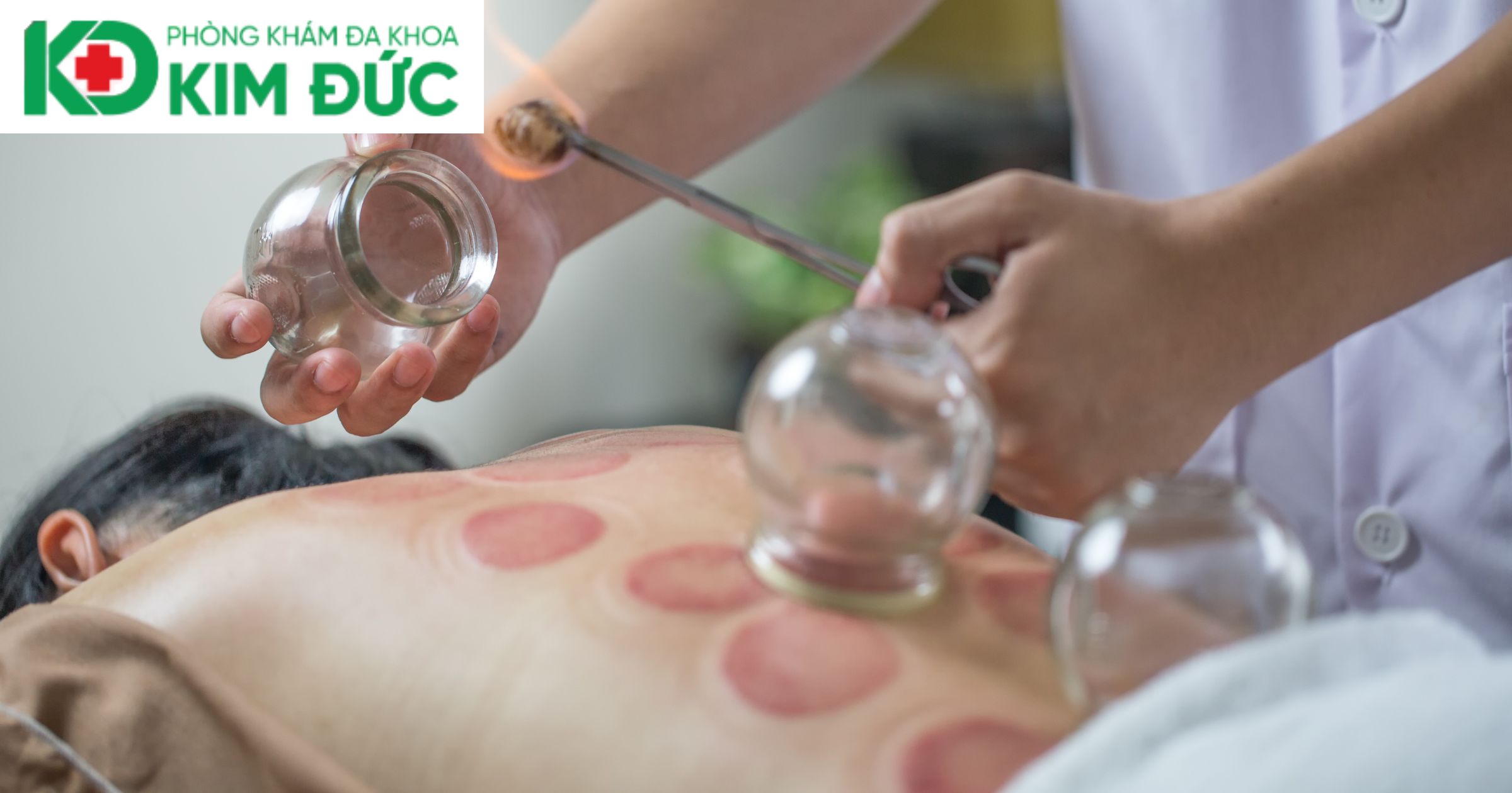 Điều trị Y Học Cổ Truyền