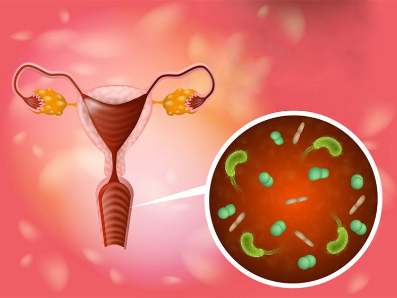điều trị viêm nhiễm phụ khoa