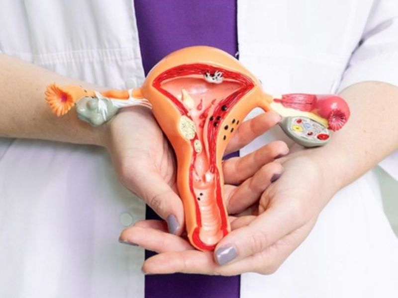 điều trị viêm nhiễm phụ khoa