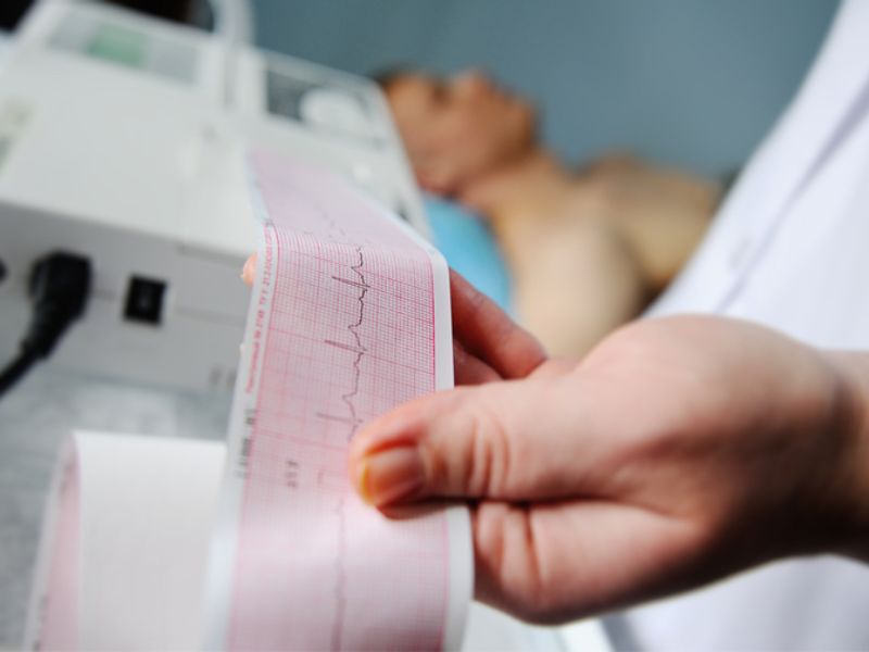 đo điện tim ECG