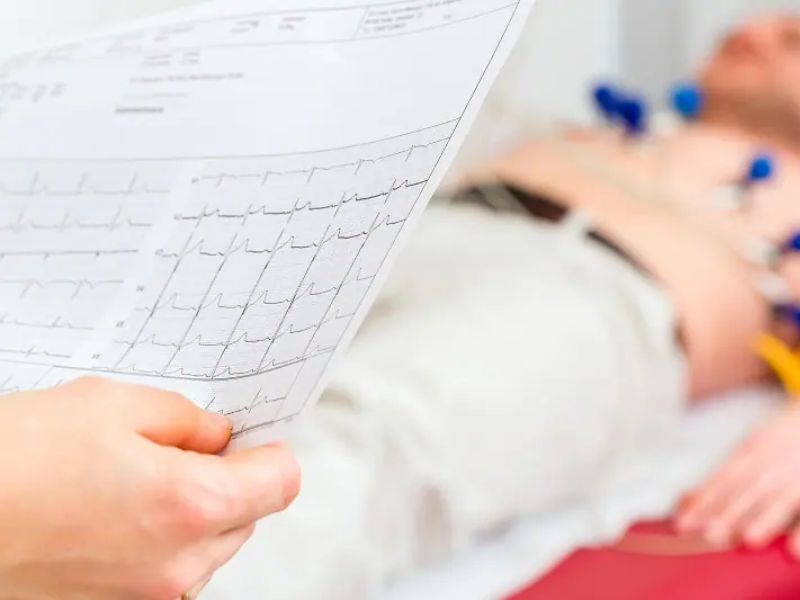 đo điện tim ECG