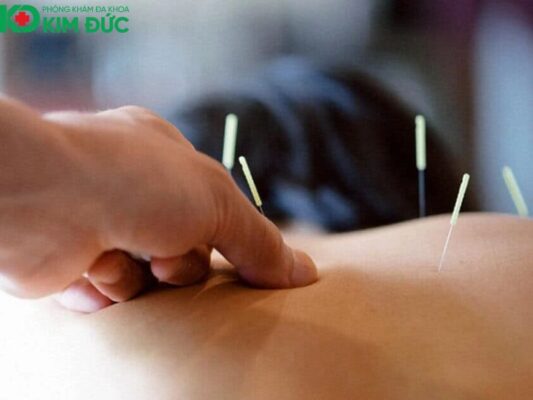 y học cổ truyền phục hồi chức năng