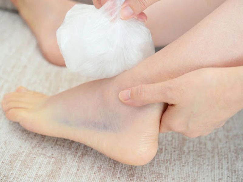 điều trị bong gân