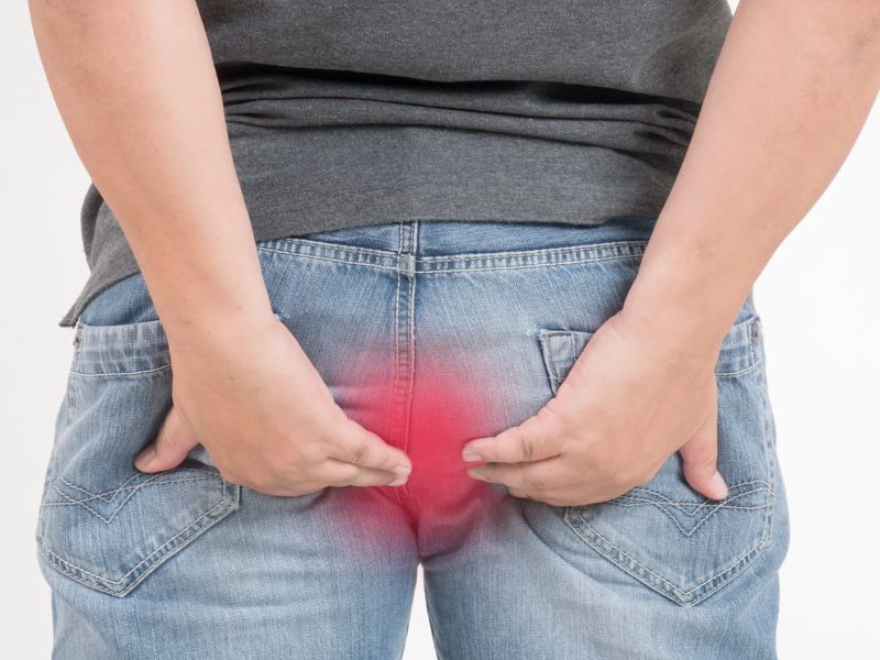 điều trị rò hậu môn