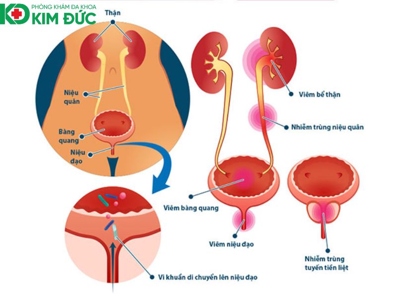 ngoại tiết niệu
