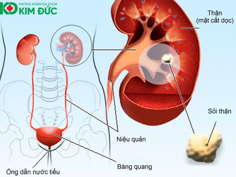 ngoại tiết niệu