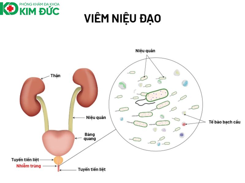 ngoại tiết niệu