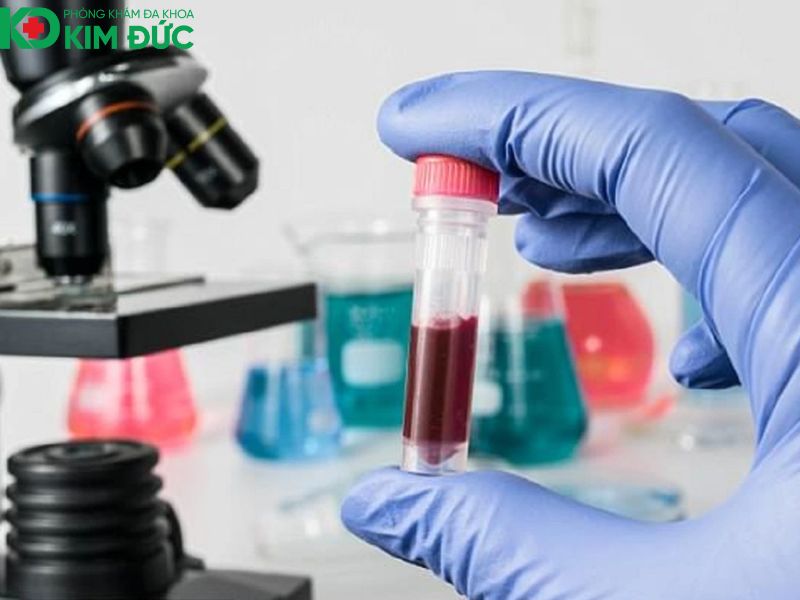 Xét nghiệm là gì