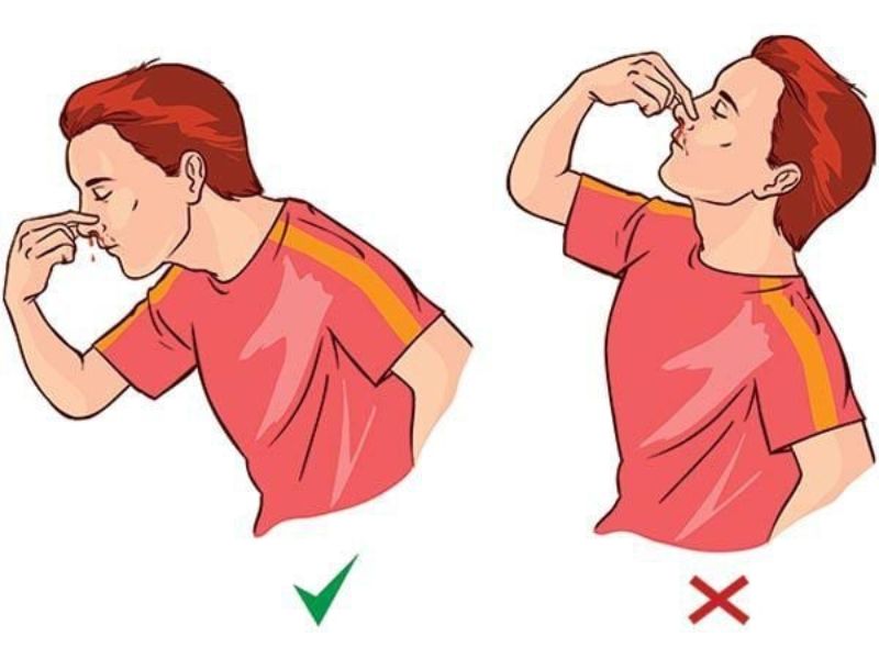 chảy máu cam liên tục là bệnh gì