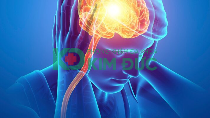 So sánh nguyên nhân gây đau nửa đầu, vai gáy và cổ