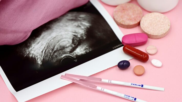 kết quả xét nghiệm dự đoán