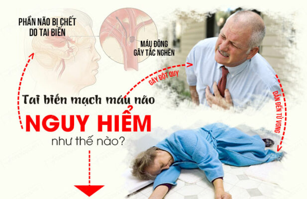 Rối loạn về nhận thức và trí nhớ