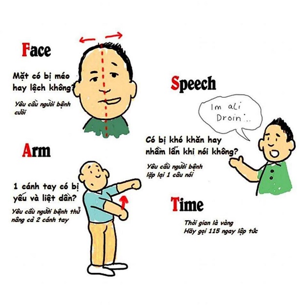 di chứng tai biến mạch máu não