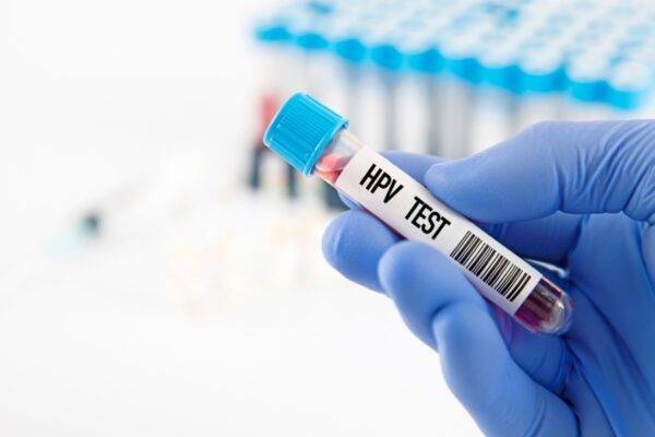 Bác sĩ Phòng khám Kim Đức đang tận tình tư vấn kết quả test HPV cho khách hàng.