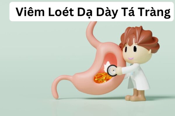 Viêm loét dạ dày tá tràng