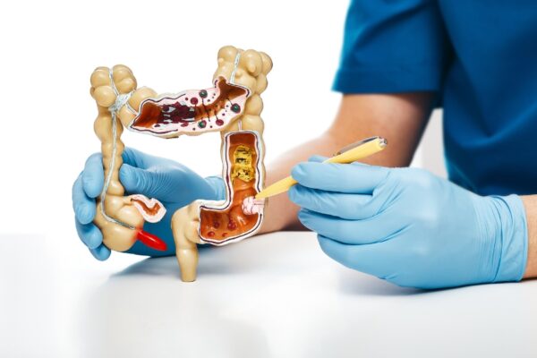 Nguyên nhân nào gây ra tình trạng viêm ruột thừa?