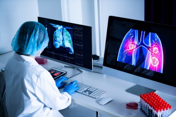 Dấu hiệu viêm phổi nặng ở người lớn