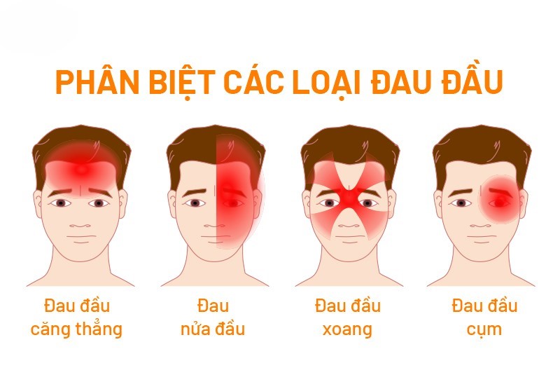 Phân biệt các loại đau đầu
