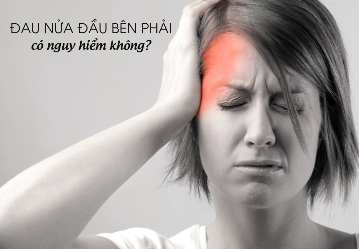 Một người đang ôm đầu vì bị đau nửa đầu bên phải dữ dội.