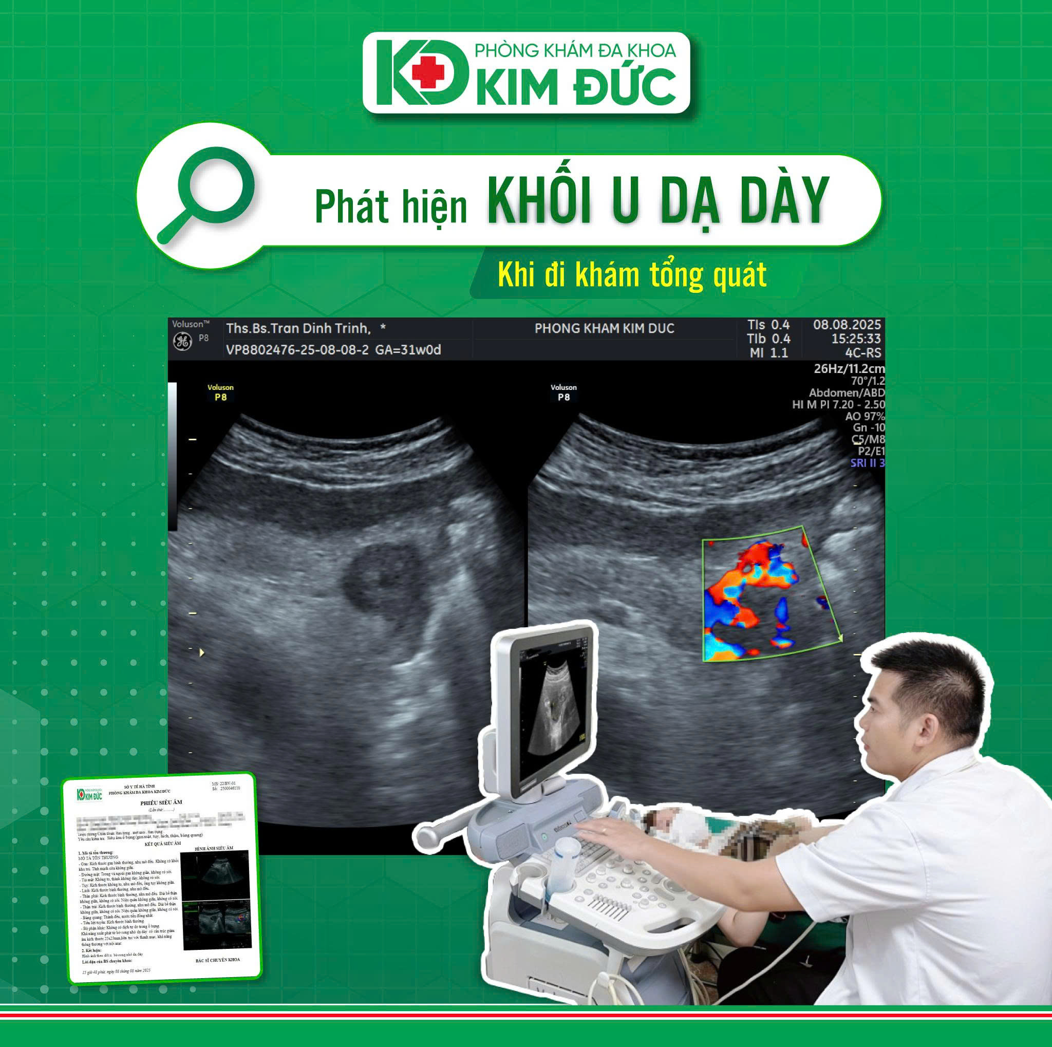 Khám tổng quát nội soi dạ dày