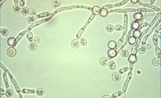 Nấm âm đạo Candida albicans