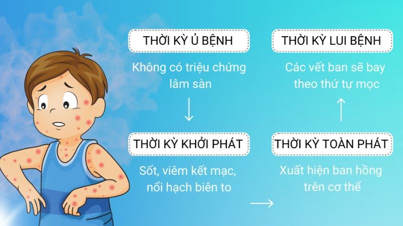 Giai đoạn biểu hiện của bệnh sốt phát ban