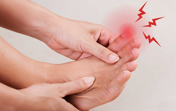Triệu chứng sưng đỏ và viêm tấy của khớp ngón chân cái trong cơn Gout cấp.