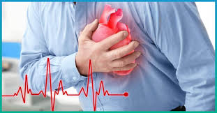 Hình ảnh rối loạn nhịp tim