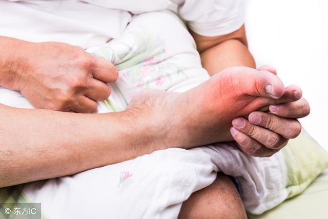 Người bệnh Gout đang tự kiểm tra khớp ngón chân cái bị sưng và đau.