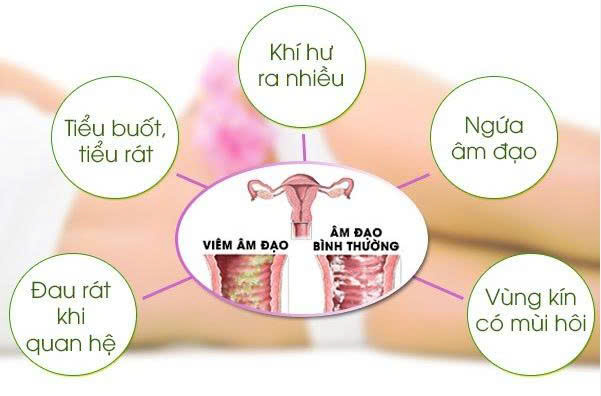 Dấu hiệu của bệnh phụ khoa liên quan đến các vùng giải phẫu cơ quan sinh dục nữ