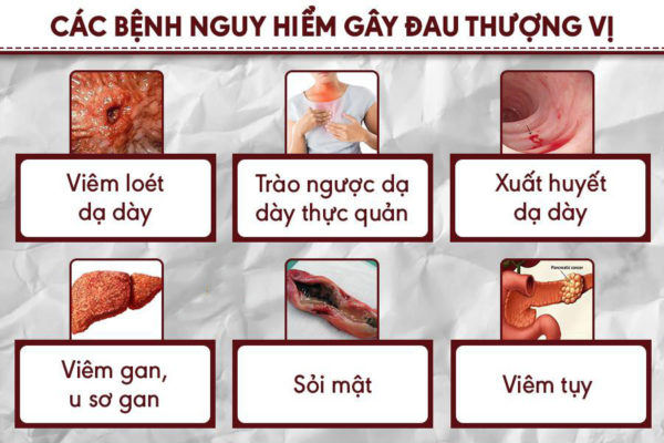 đau thượng vị đầy bụng ợ chua buồn nôn