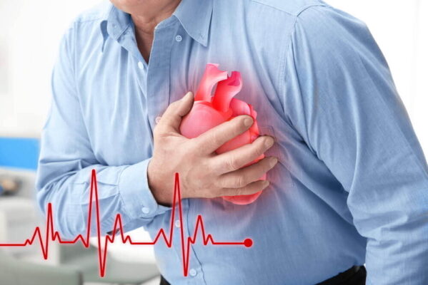 Khi nào cần cấp cứu đau ngực liên quan mạch vành tim