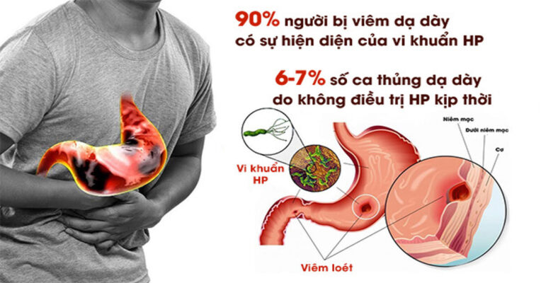 vi khuẩn HP gây viêm dạ dày và đường lây nhiễm