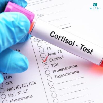 xét nghiệm cortisol đối với hội chứng Cushing suy thượng thận
