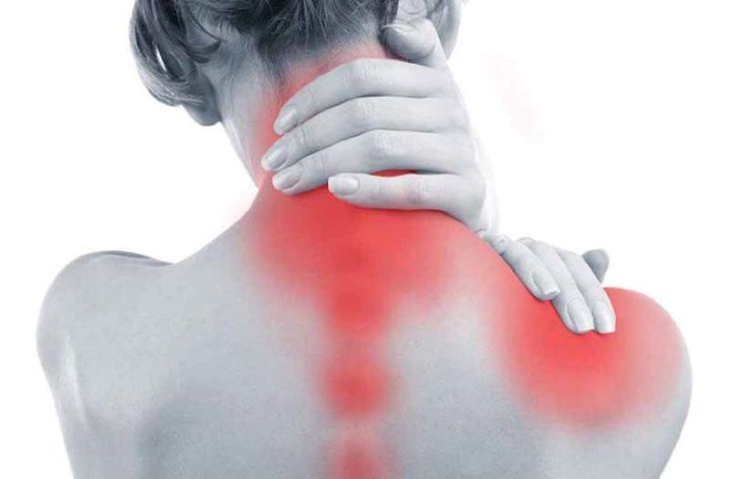 Hình minh họa đau cổ vai gáy với cảm giác đau mỏi và co cứng vùng cổ vai gáy.