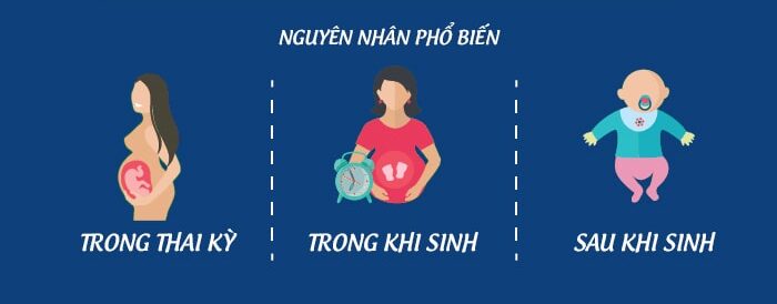 bại não ở trẻ em yếu tố nguy cơ trước sinh trong sinh sau sinh