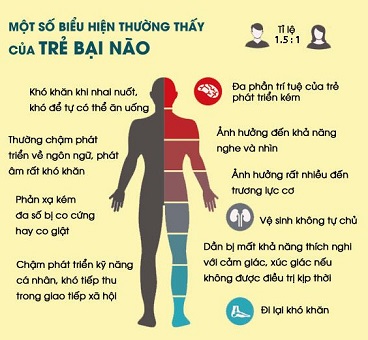 dấu hiệu bại não sớm và phục hồi chức năng bại não cho trẻ chậm phát triển vận động