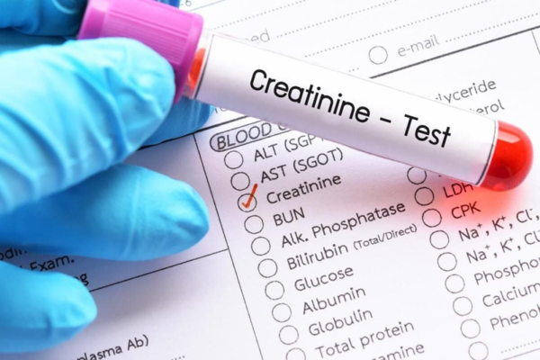 Xét nghiệm nước tiểu, creatinin và eGFR giúp đánh giá sớm nguy cơ viêm cầu thận.