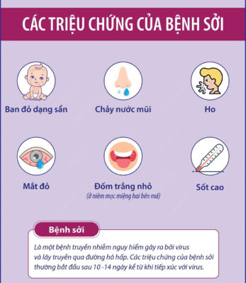 Dấu hiệu của bệnh sởi ở trẻ gồm sốt ho chảy mũi đỏ mắt và phát ban