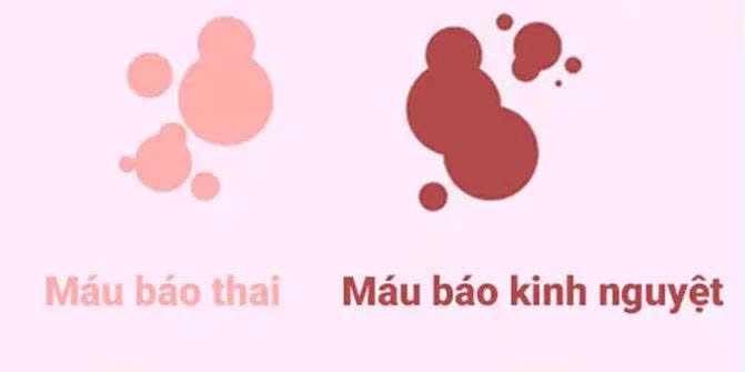 dấu hiệu mang thai 2 tuần đầu và cách nhận biết
