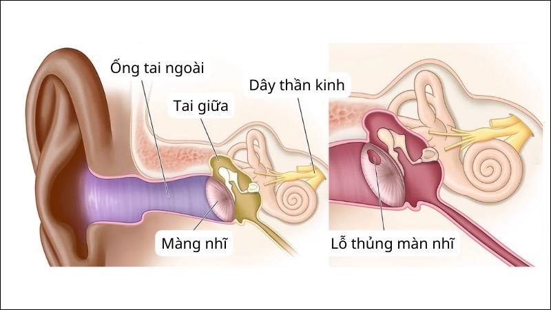 dấu hiệu thủng màng nhĩ và cấu tạo màng nhĩ