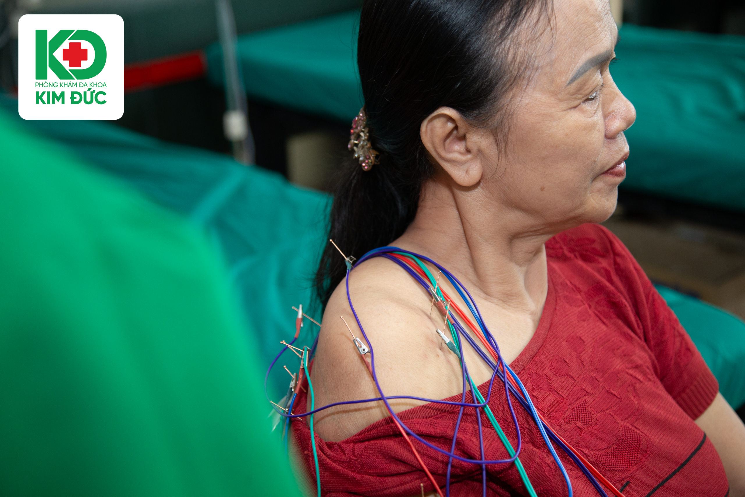 Điều trị đau khớp vai Hà Tĩnh tại Phòng khám Đa khoa Kim Đức