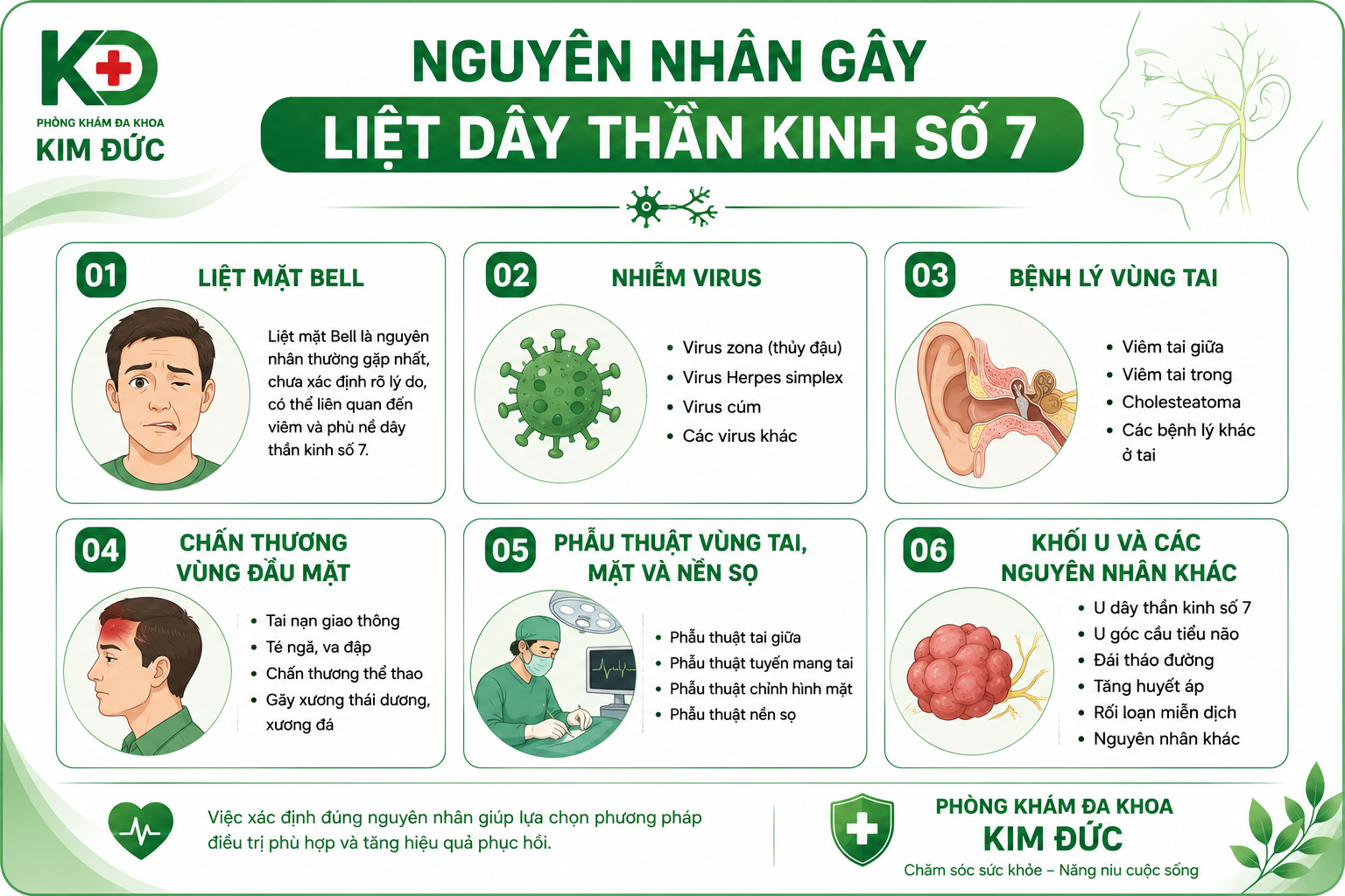 Nguyên nhân gây liệt dây thần kinh số 7